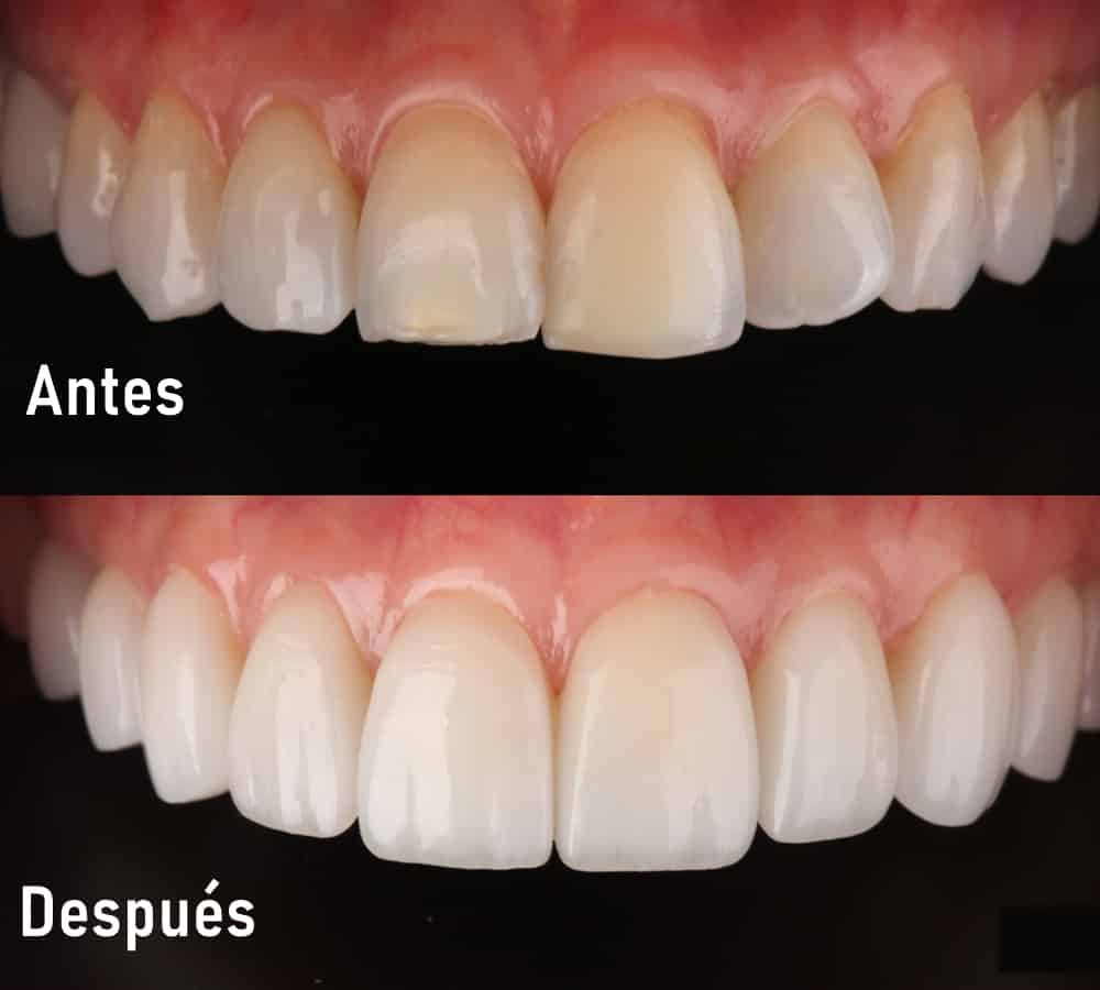Tratamiento de ortodoncia y ortopedia